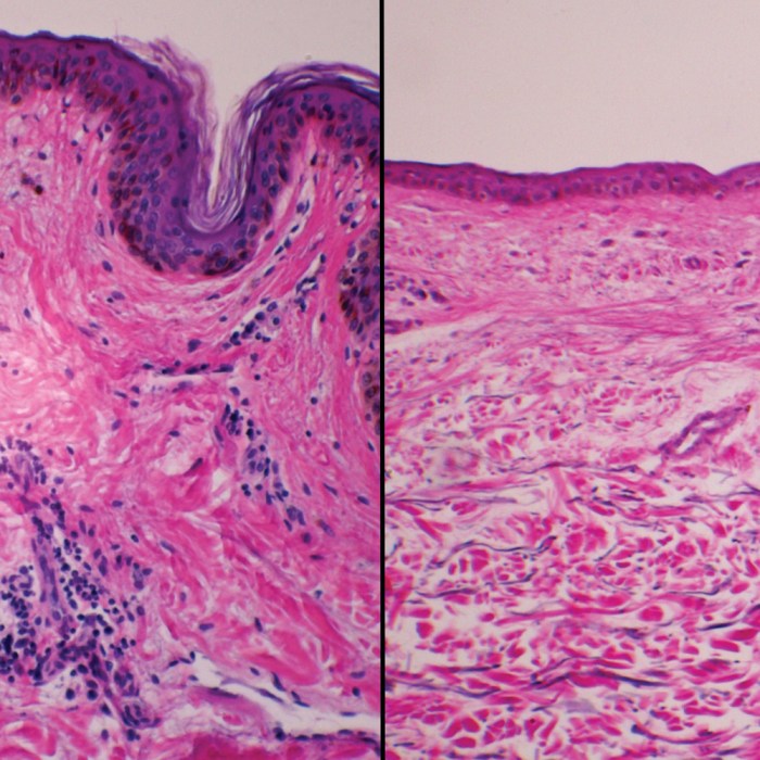 Human non pigmented skin slide labeled