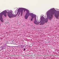 Human non pigmented skin slide labeled