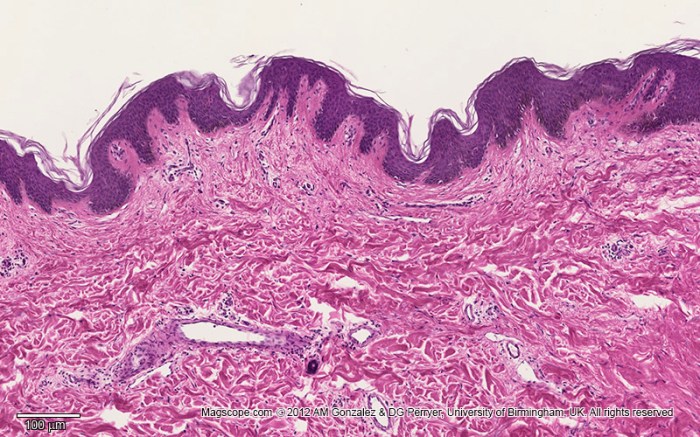 Human non pigmented skin slide labeled