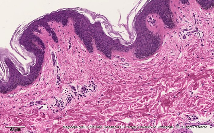 Skin human epidermis slide dermis layers histology illustrating magnification micrograph low different