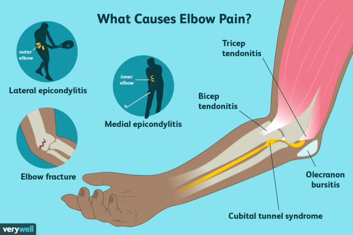 Which bursae are between the client's elbow and the skin